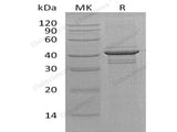 Recombinant Human Calreticulin-3/CALR3 Protein