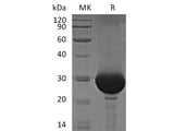 Recombinant Human Carbonic Anhydrase 1/CA1 Protein (His Tag)(Active)