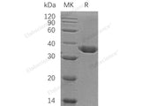 Recombinant Human Carbonic Anhydrase 10/CA10 Protein (Human Cells, His Tag)