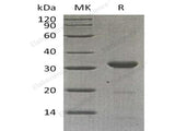 Recombinant Human Carbonic Anhydrase 10/CA10 Protein (E.coli, His Tag)