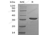 Recombinant Human Carbonic Anhydrase 13/CA13 Protein (His Tag)(Active)