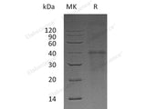 Recombinant Human Carbonic Anhydrase 14/CA14 Protein (E.coli, His Tag)