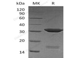 Recombinant Human Carbonic Anhydrase 4/CA4 Protein (His Tag)