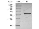 Recombinant Human Carbonic Anhydrase 5B/CA5B Protein (His Tag)