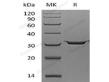 Recombinant Human Carbonic Anhydrase 7/CA7 Protein (His Tag)(Active)