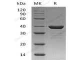 Recombinant Human Carbonic Anhydrase 8/CA8 Protein (His Tag)(Active)