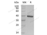 Recombinant Human CA11 Protein (His Tag)