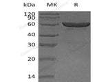 Recombinant Human Carboxylesterase 1/CES1 Protein (His Tag)