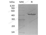 Recombinant Human Carboxypeptidase A1/CPA1 Protein (His Tag)