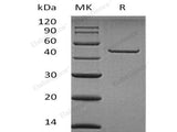 Recombinant Human Carboxypeptidase A2/CPA2 Protein (His Tag)