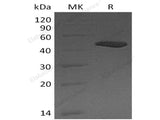 Recombinant Human Carboxypeptidase B1/CPB1 Protein (His Tag)