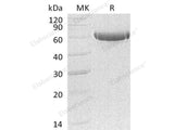 Recombinant Human Carboxypeptidase B2/CPB2 Protein (His Tag)