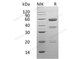 Recombinant Human Carboxypeptidase E/CPE Protein (His Tag)