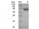 Recombinant Human Carboxypeptidase M/CPM Protein (His Tag)