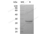 Recombinant Human Cardiotrophin-1/CTF1 Protein (His Tag)