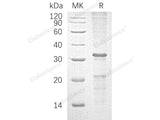 Recombinant Human Caspase-10/CASP10 Protein (His Tag)