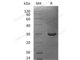 Recombinant Human Caspase-14/CASP14 Protein (His Tag)