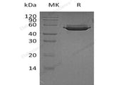 Recombinant Human Cathepsin A/CTSA Protein (His Tag)