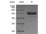 Recombinant Human Cathepsin B/CTSB Protein (His Tag)