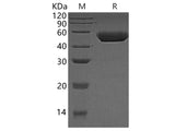 Recombinant Human Cathepsin D/CTSD Protein (His Tag)