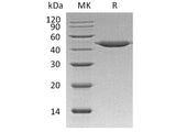 Recombinant Human Cathepsin E/CTSE Protein (His Tag)