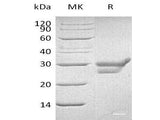 Recombinant Human Cathepsin L/CTSL Protein (His Tag)