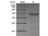 Recombinant Human Cathepsin L2/CTSL2 Protein (His Tag)