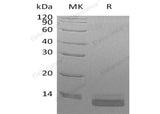 Recombinant Human CCL14/HCC-3 Protein (His Tag)