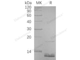 Recombinant Human CCL18 Protein (His Tag)