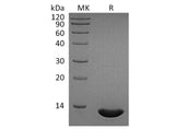 Recombinant Human CCL2/MCP-1 Protein