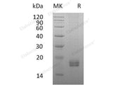 Recombinant Human CCL24/Eotaxin-2 Protein (His Tag)