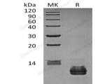 Recombinant Human CCL27 Protein