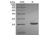 Recombinant Human CCL3L1 Protein (His Tag)