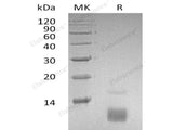 Recombinant Human CCL5/RANTES Protein