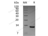 Recombinant Human CCL8/MCP-2 Protein (Human Cells, His Tag)