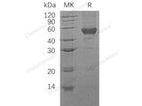 Recombinant Human CD14 Protein (aa 20-352, His Tag)