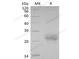 Recombinant Human CD160/BY55 Protein (aa 27-159, His Tag)(Active)