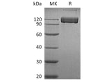 Recombinant Human ALCAM/CD166 Protein (Fc Tag) 