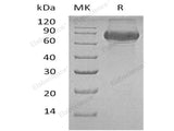 Recombinant Human CD19/Leu-12 Protein (Fc Tag)(Active)