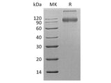 Recombinant Human CD200R1 Protein (Fc Tag)