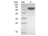 Recombinant Human CD27/TNFRSF7 Protein (Fc & His Tag)