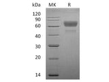 Recombinant Human CD28/TP44 Protein (Fc Tag)