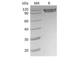 Recombinant Human CD30/TNFRSF8 Protein (Fc Tag) 