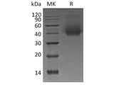 Recombinant Human CD44 Protein (His Tag)