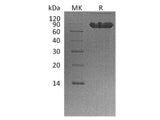 Recombinant Human CD44 Protein (Fc Tag)