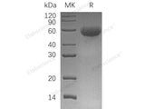 Recombinant Human CD46 Protein (His Tag)