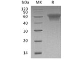 Recombinant Human CD55/DAF Protein (His Tag)