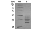 Recombinant Human CD83/HB15 Protein (His Tag)