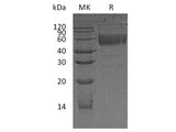 Recombinant Human CD83/HB15 Protein (Fc Tag)