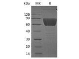 Recombinant Human CD99L2 Protein (Fc Tag)